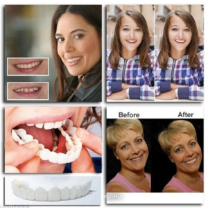 Tiworld™ Adjustable Snap-On Dentures