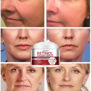 Tiworld™ Retinol & Collagen Moisturizer Face Cream