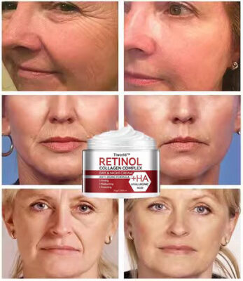 Tiworld™ Retinol & Collagen Moisturizer Face Cream