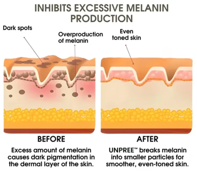 UNPREE Vitamin C Skin Whitening Serum - Image 4