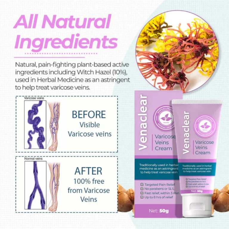 Venaclear™ Varicose Veins Cream