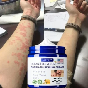 VolumElle™ Bee Venom & Ocean Psoriasis Healing Cream