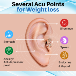 AEXZR™ Acupressure Slimming Earrings