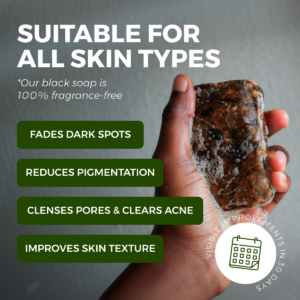 Anti-Acne & Dark Spots African Soap Bar