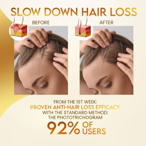 Stovis™ Biotin Boost Hair Growth Spray