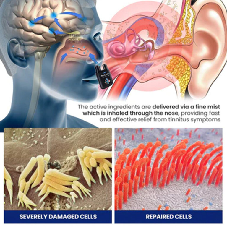 UNPREE™ TINNICLEAR Tinnitus Relief Nasal Inhaler