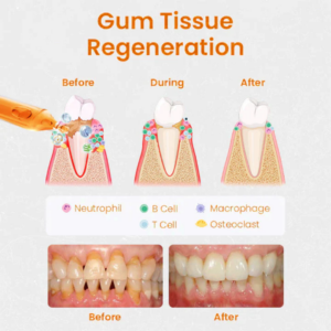 AEXZR™ Gum Repair Treatment Ampoules