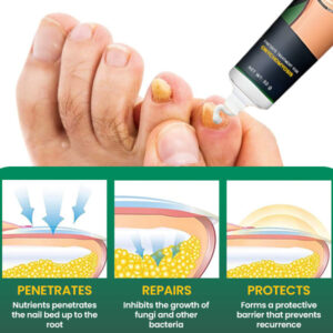 AEXZR™ Nail Care Anti Fungal Cream