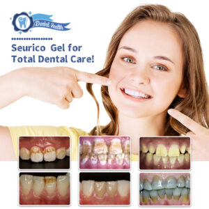 Seurico™ Xylitol Strong Refreshing Whitening Tooth Gel