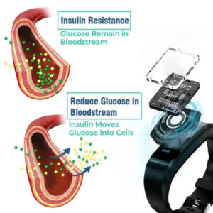 Ultrasound Wristband for Diabetes & Obesity