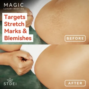 STDEI™ MAGIC LUXURY BODY OIL