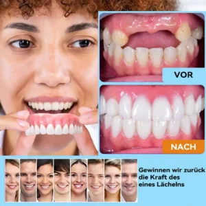 Bikenda™ Silikon Reline Denture Setzen