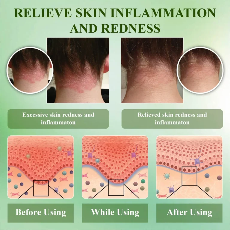 RelievaDerm™ Aloe SkinTherapy HydratingGel