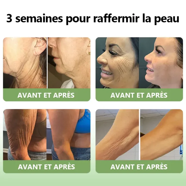 STDEI™ Crème Raffermissante au Collagène de Luxe