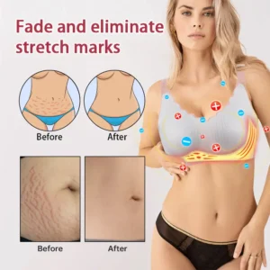 𝐃𝐞𝐭𝐨𝐱 Shaping Bra - All-Day Tender Care