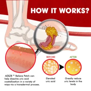 AEXZR™ Gout Relieve Patch