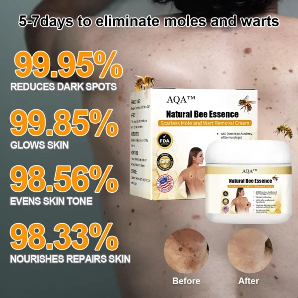 AQA™ Natural Bee Essence Mole and Wart Treatment Cream - Image 8