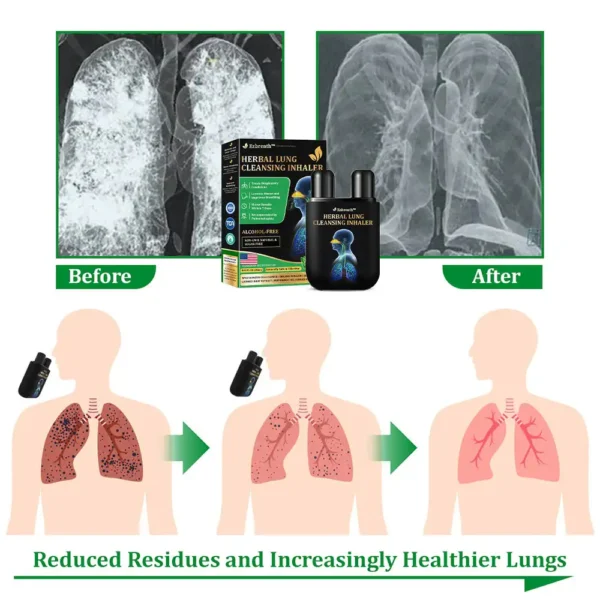 Ezbreath™ Herbal Lung Cleansing Inhaler - Image 6