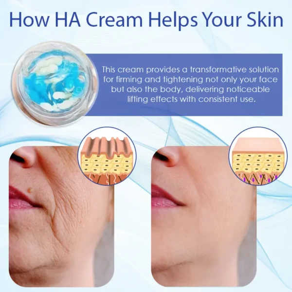 HZA™ Deep Elastic SkinRenew HA Cream - Image 8