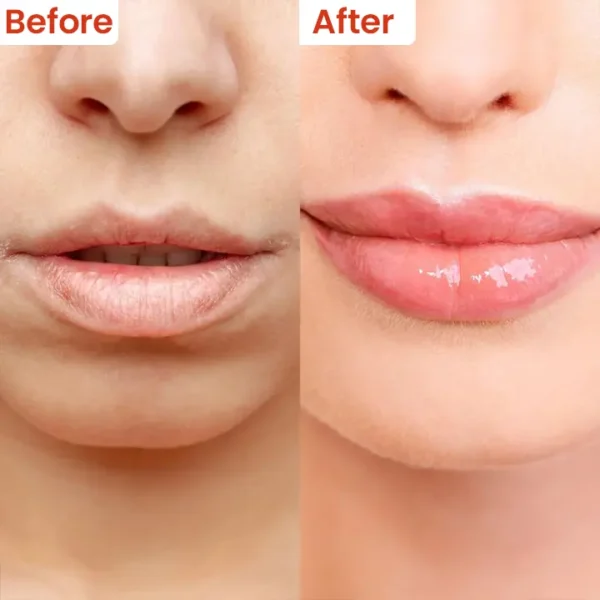 LIMETOW™ Cheilitis Cream - Image 11