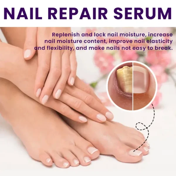 LIMETOW™ Multi-Purpose Nail Repair - Image 8