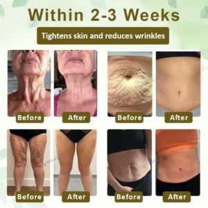 TightenLift™ SkinRenewal FirmingOil