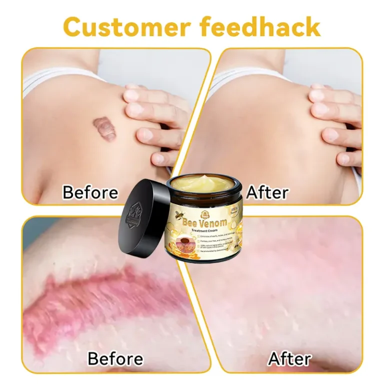 Turonu™ Bee Venom Skin Treatment Cream