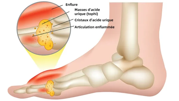 ArthroFree™ Venin D'abeille Crème - Image 41