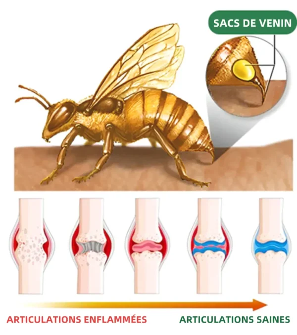 ArthroFree™ Venin D'abeille Crème - Image 48