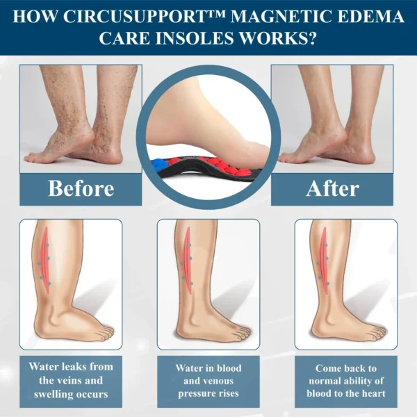 CircuSupport™ Magnetic EdemaCare Insoles - Image 7