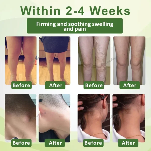 DetoxFlow™ SwellSoothe Lymphatic Cream - Image 3