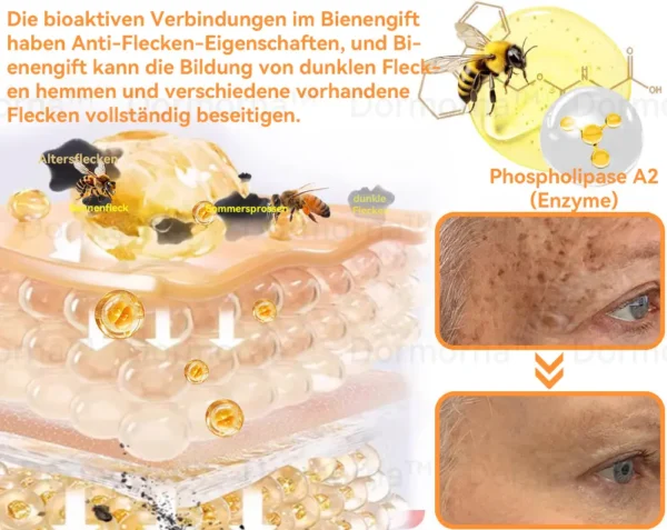 Dormorna™ Bienengift Alles-in-Einem Creme - Image 7