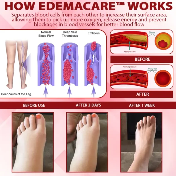 EdemaCare™ VenoLymph Massage Therapy Cream - Image 10