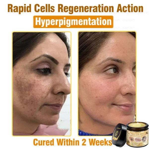 Lotmay™ 7-Day Rapid Skin Rapair Cream US Dermatologist Approved - Image 9