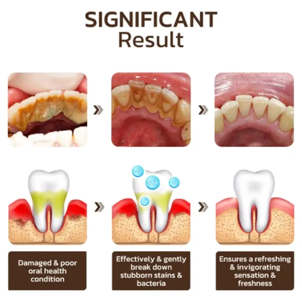 Seurico™ Niacinamide Whitening Toothpaste - Image 5