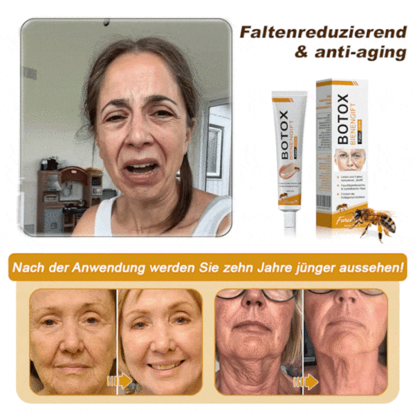 Spzv™ Botox Bienenvenom Faltenentfernungscreme - Image 9