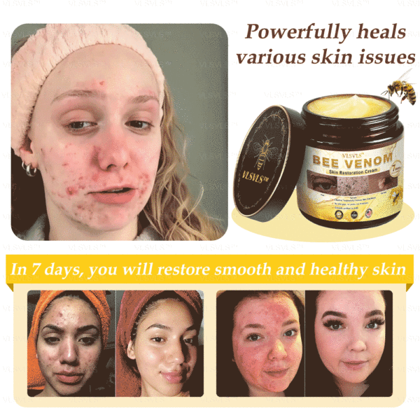 VLSVLS™ Bee Venom Skin Restoration Cream - Image 2