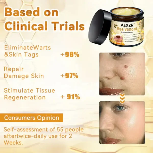 Winter Sale AEXZR™ Bee Venom Skin Treatment Cream - Image 8