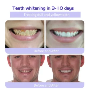 Winter Sale GarageLine™ Tooth Restoration Mineral Powder